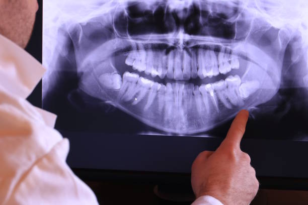 Best Emergency Gum Pain Relief  in Plain City, OH