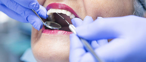 Best Tooth Infection Emergency Dentist  in Plain City, OH